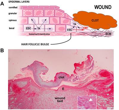 The Epidermis in Microgravity and Unloading Conditions and Their Effects on Wound Healing